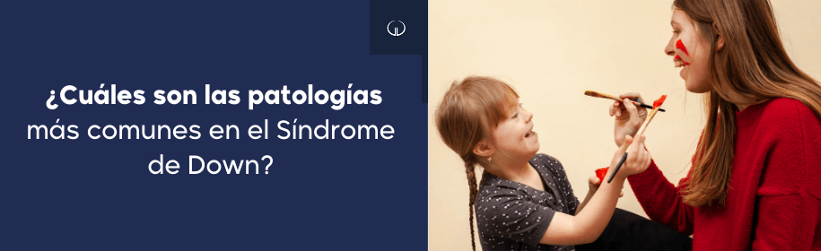 ¿Cuáles son las patologías más comunes en el Síndrome de Down?