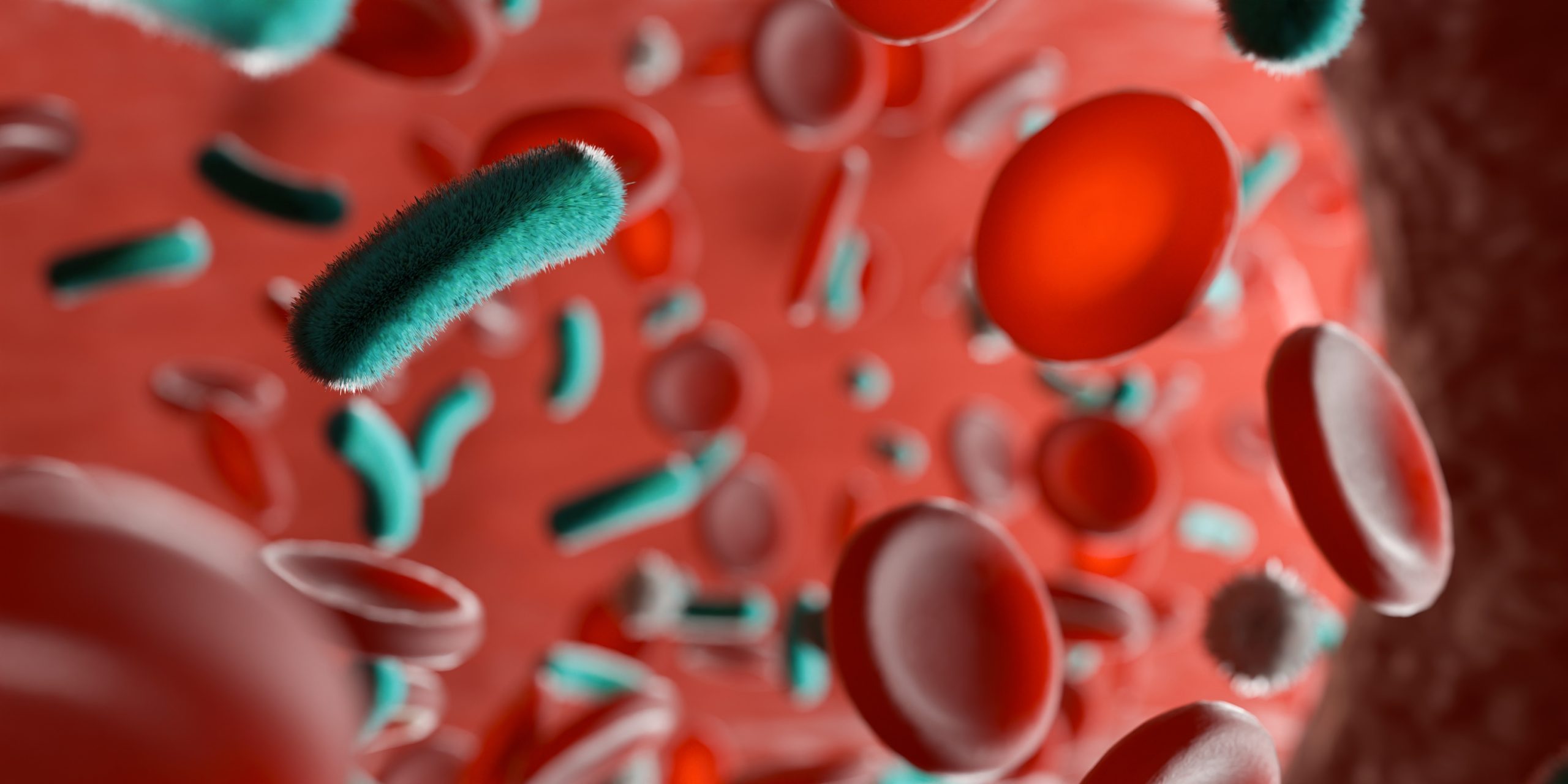 ¿Qué es la sepsis y por qué da?
