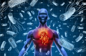 ¿Qué es la sepsis y por qué da?