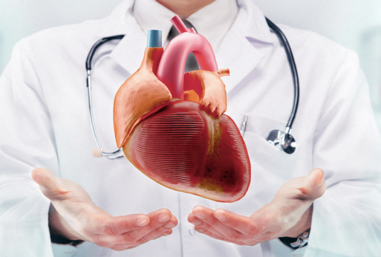 Hipertensión: ¿Cuándo acudir al cardiólogo?