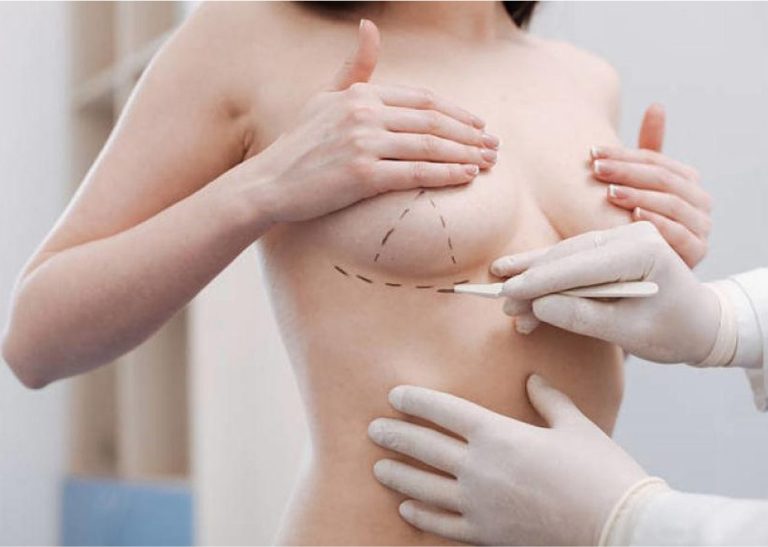 Enfermedad de biopolimeros/Reconstrucción mamaria