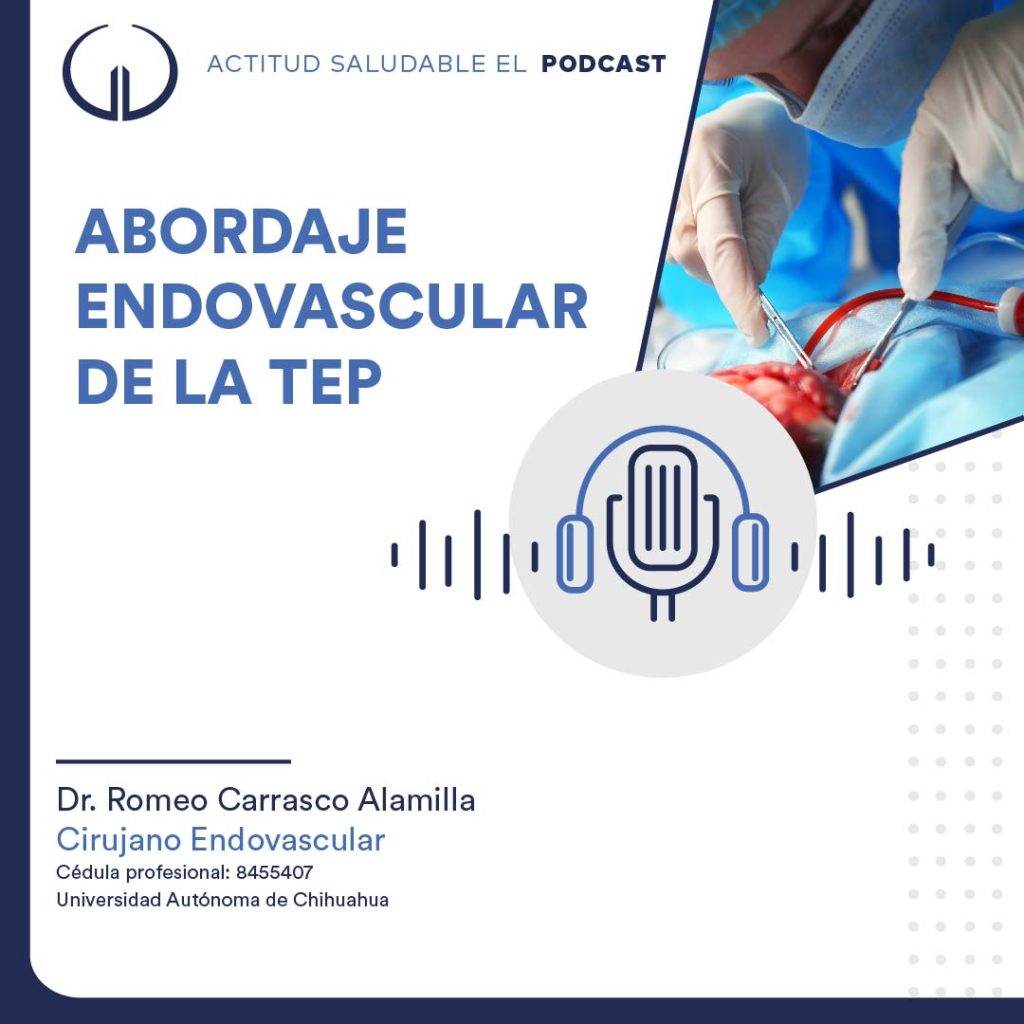 Abordaje endovascular de la TEP | Hospital Galenia - E312