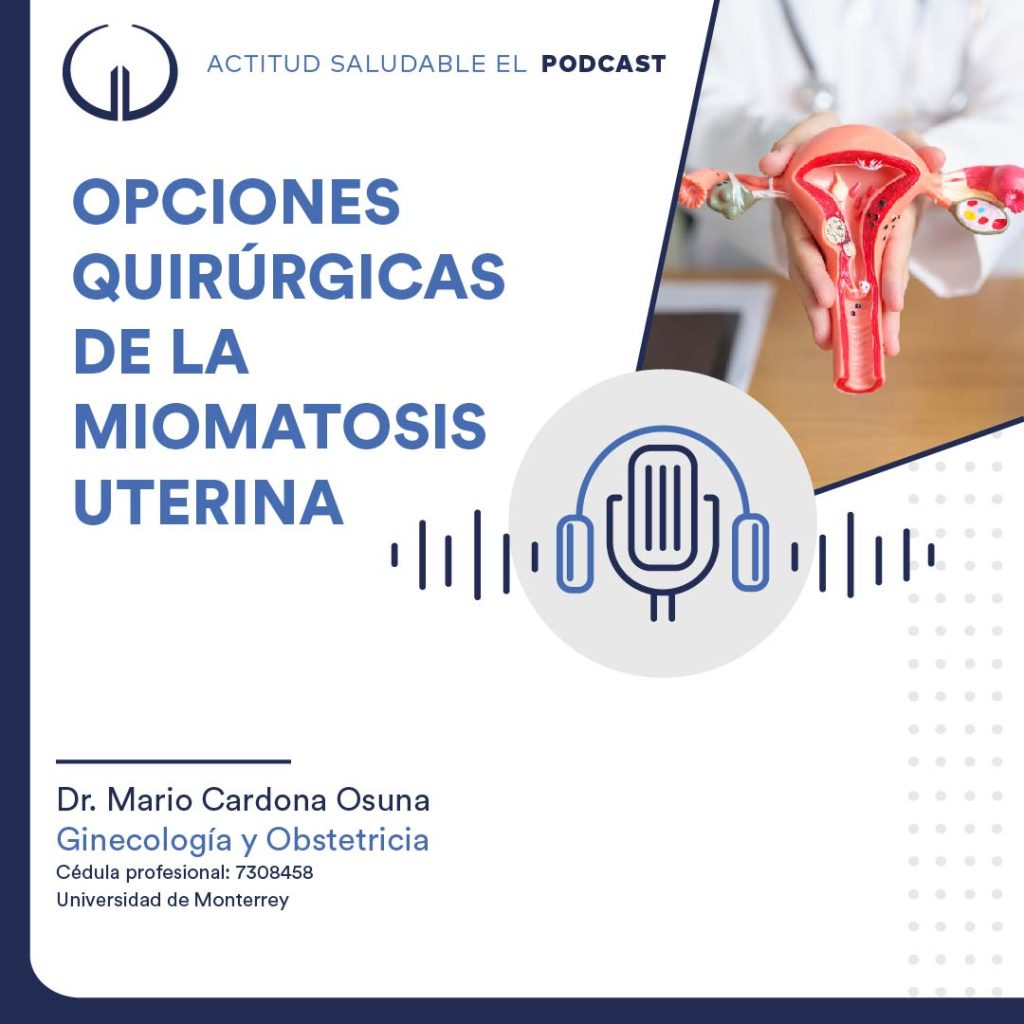 Opciones quirúrgicas de la miomatosis uterina | Hospital Galenia - E313