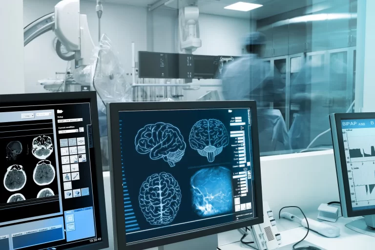 Imagen en Stroke en Hospital Galenia