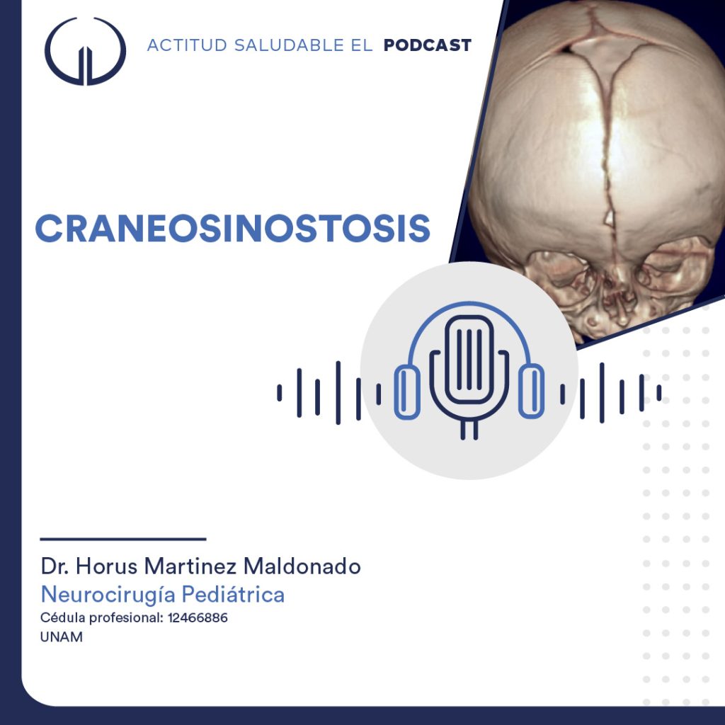 Craneosinostosis | Hospital Galenia - E320