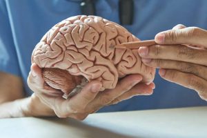 Código stroke en Neurología
