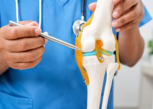 Beneficio de las células madre en la osteoartosis