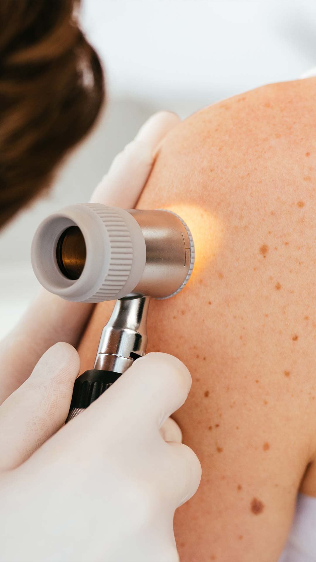 Clínica de Cáncer de piel y sarcóma