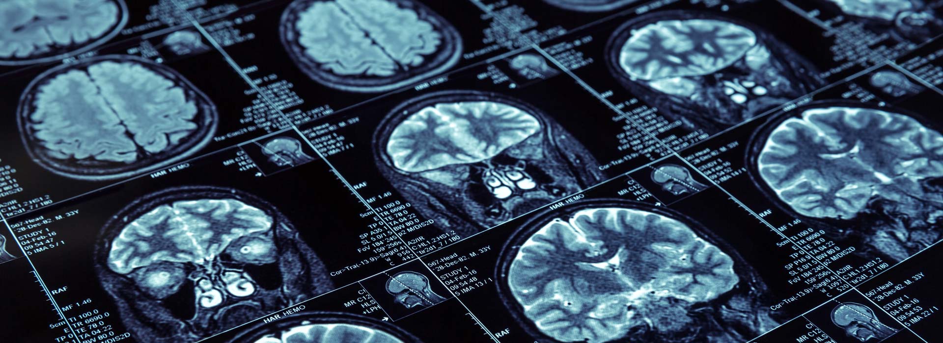Clinica de Memoria del Hospital Galenia